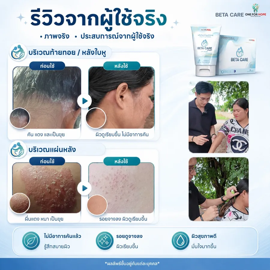 รีวิวจากผู้ใช้จริง บริเวณท้ายทอยและแผ่นหลัง