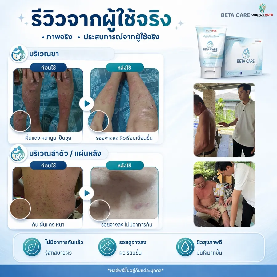 รีวิวจากผู้ใช้จริง บริเวณขาและลำตัว