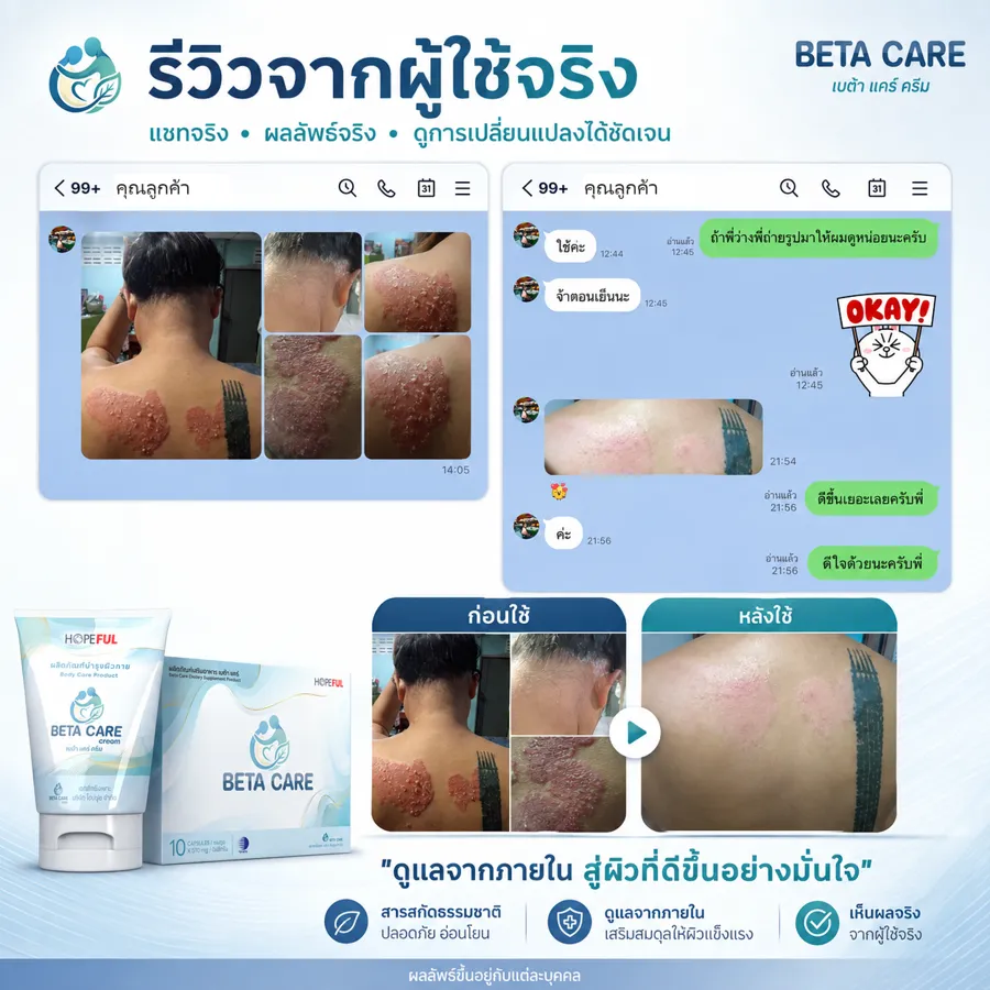 รีวิวจากแชทลูกค้าจริง